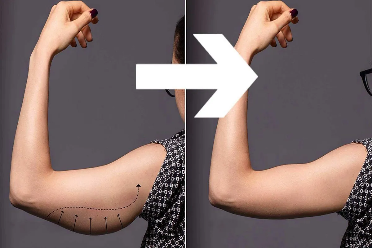 Versterk je armen met pilates: eenvoudige oplossingen voor strakkere armen